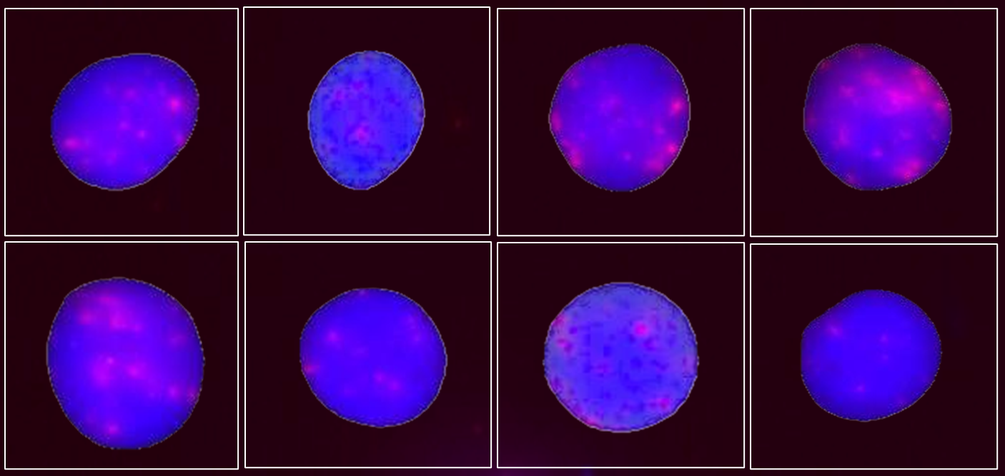 Proyecto: Detección del daño genético inicial inducido por las radiaciones ionizantes. Evaluación de su aplicabilidad como biomarcador de radiosensibilidad