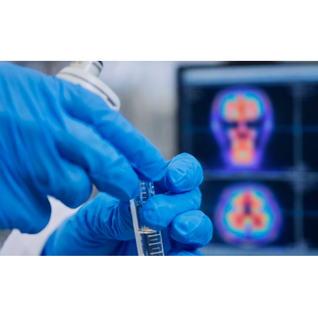 Desbloqueando el potencial de los radiofármacos en Europa – Parte 1: Situación actual y perspectivas de la medicina nuclear